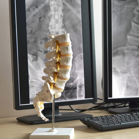 Chiropractor Spine – Chiropractor in Riverside CA – Whole Body Wellness Chiropractor Spine - Chiropractor in Riverside CA - Whole Body Wellness