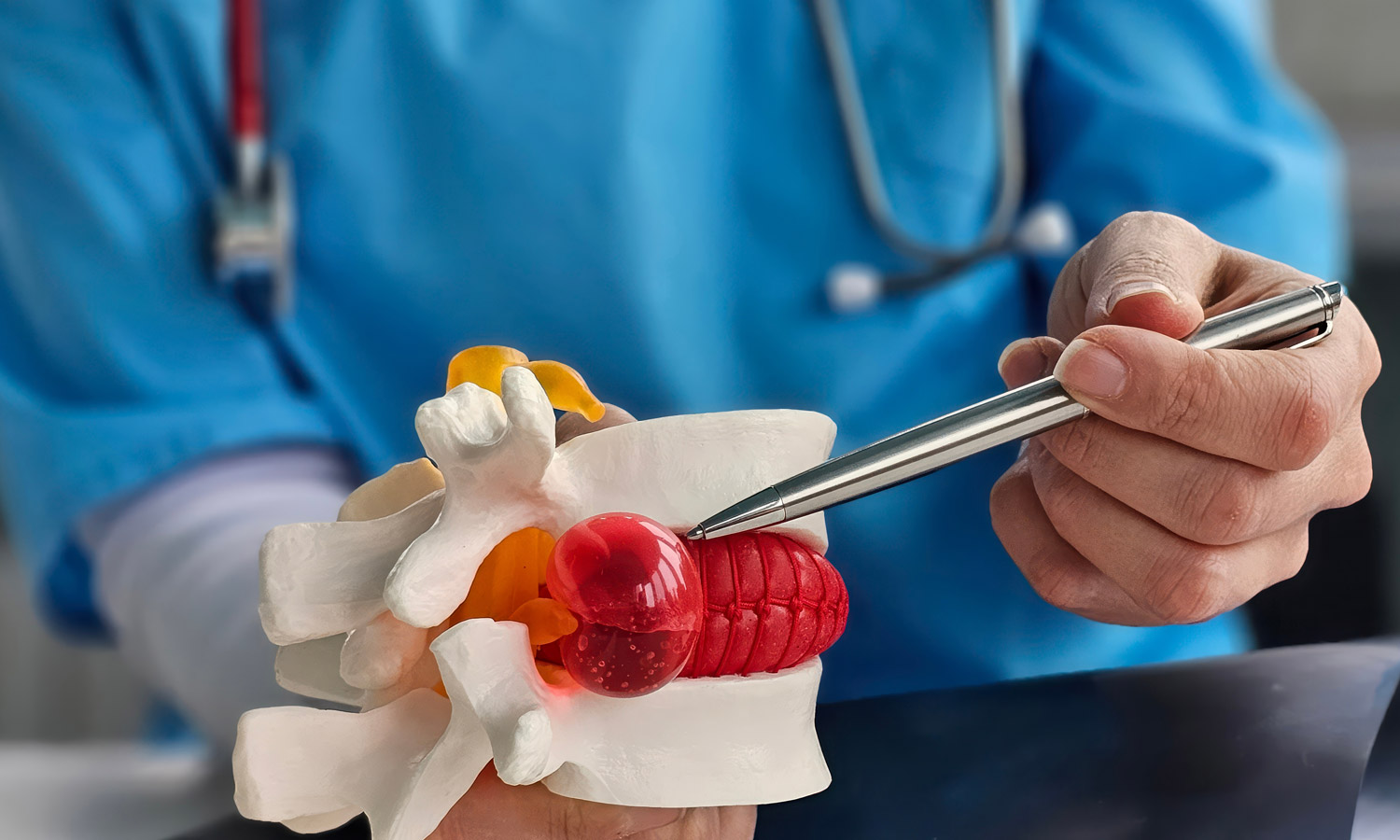 spinal decompression for herniated disc